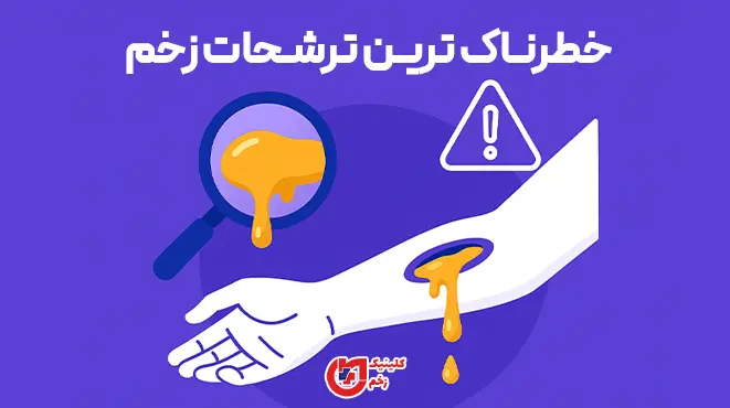 اینفوگرافیک ترشحات خطرناک زخم: افزایش درد و قرمزی، بوی نامطبوع، تغییر رنگ ترشح (سبز/زرد تیره/قهوه‌ای)، تب یا تورم