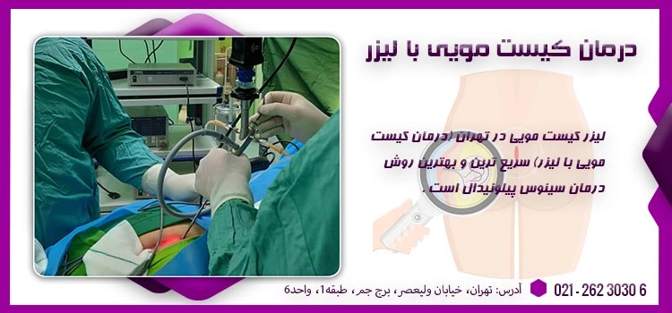 درمان کیست مویی با لیزر در تهران