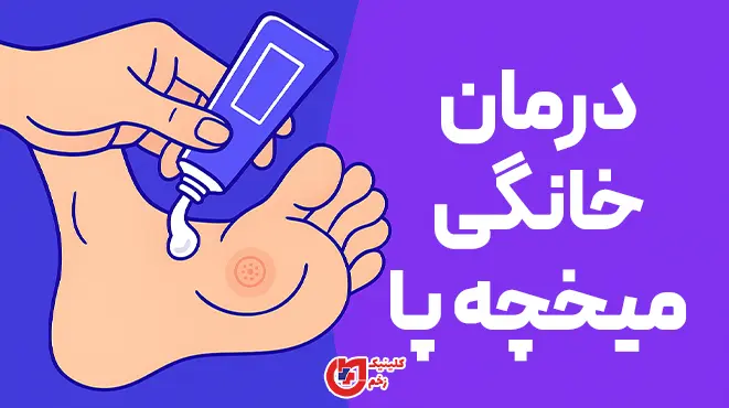 نمای نزدیک میخچه پا؛ راهنمای درمان‌های خانگی کم‌خطر، پیشگیری با کفش مناسب و محافظت از پوست