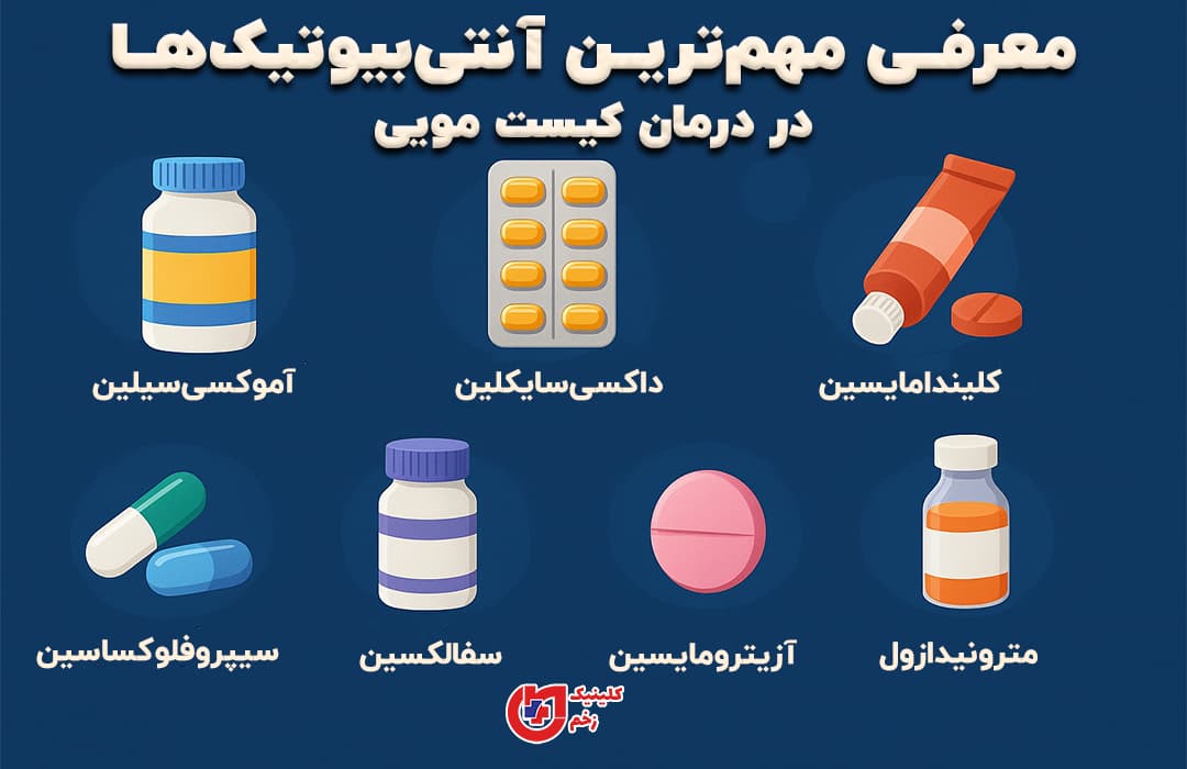 اینفوگرافی گرافیکی با نمایش ۸ آنتی‌بیوتیک مؤثر در درمان کیست مویی شامل آموکسی‌سیلین، داکسی‌سایکلین، کلیندامایسین، سیپروفلوکساسین، سفالکسین، آزیترومایسین، مترونیدازول و وانکومایسین، با طراحی بصری جذاب و آیکون‌های دارویی