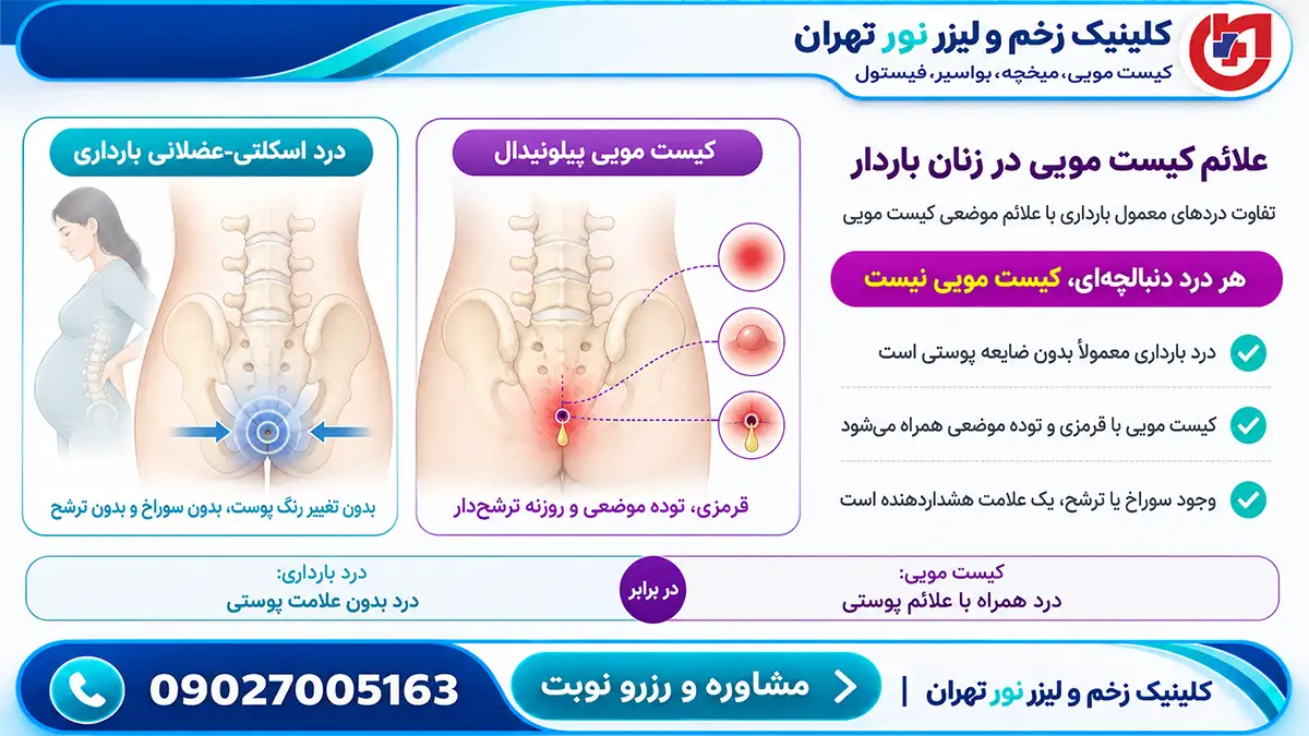 اینفوگرافیک تشخیص تفاوت درد طبیعی دنبالچه با علائم کیست مویی در دوران بارداری