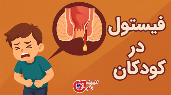 فیستول در کودکان