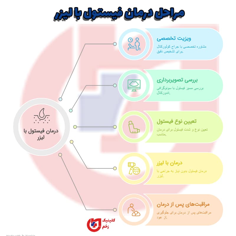 مراحل درمان فیستول با لیزر