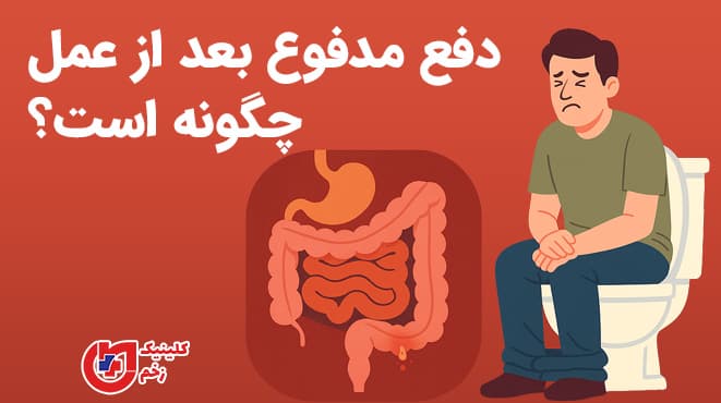 تصویر گرافیکی فارسی از مردی مضطرب روی توالت با نمایی از دستگاه گوارش، همراه با عنوان «دفع مدفوع و اجابت مزاج بعد از جراحی فیستول چگونه است؟»