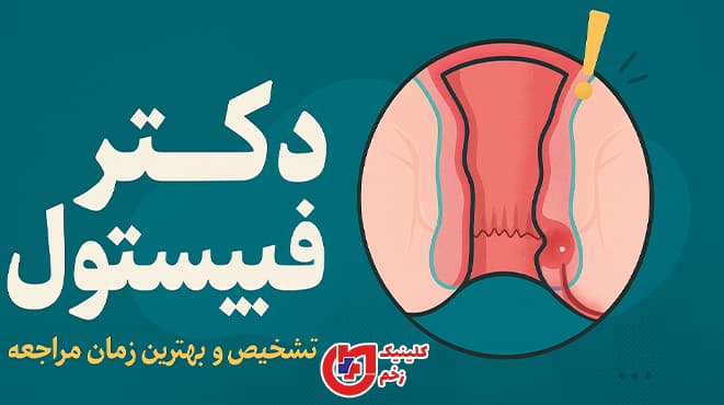 تصویر شماتیک فیستول مقعدی با متن فارسی "دکتر فیستول | تشخیص و بهترین زمان مراجعه" روی پس‌زمینه گرافیکی