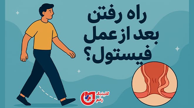 تصویر گرافیکی یک مرد در حال راه رفتن با عنوان فارسی «راه رفتن بعد از عمل فیستول؟» به‌همراه نمای شماتیک فیستول مقعدی