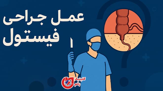 عمل جراحی فیستول