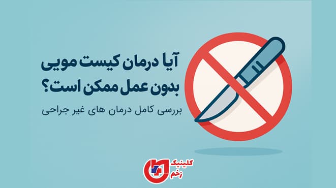 آیا درمان کیست مویی بدون جراحی ممکن است؟ بررسی روش‌های غیرجراحی مانند لیزر و دارو