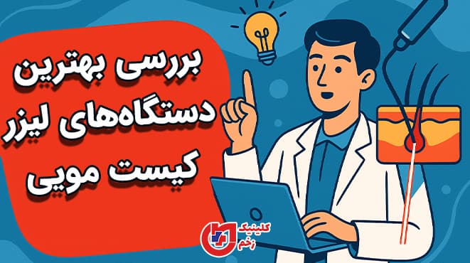 تصویر گرافیکی بررسی بهترین دستگاه‌های لیزر کیست مویی توسط دکتر در کلینیک زخم نور، با نمایش فرایند درمان و متن فارسی تبلیغاتی