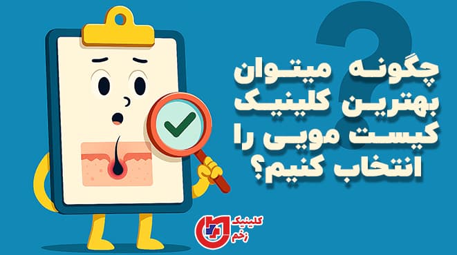 تصویر گرافیکی از فردی که در حال بررسی و انتخاب کلینیک تخصصی برای درمان کیست مویی با روش لیزر است