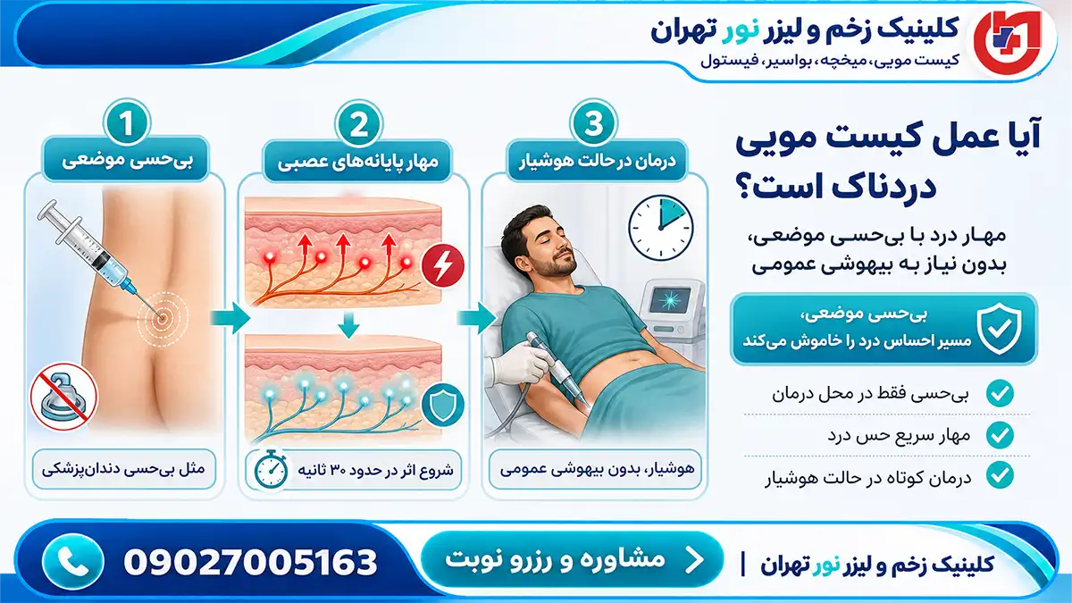 نحوه مهار کامل درد کیست مویی با بیحسی موضعی بدون نیاز به بیهوشی در اتاق عمل کلینیک زخم