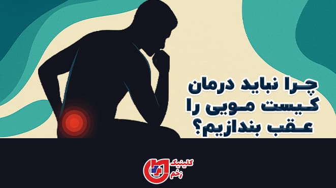 پوستر گرافیکی با یک سیلوئت نشسته که ناحیه پایین کمر آن با هاله قرمز برجسته شده و متن فارسی «چرا نباید درمان کیست مویی را عقب بیندازیم؟» به صورت جسورانه در تصویر گنجانده شده است.
