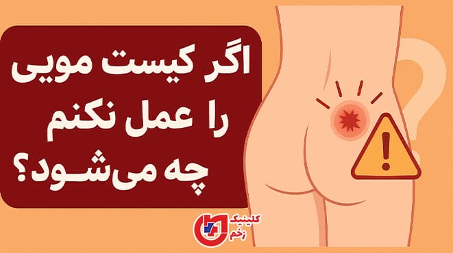 تصویر هشداردهنده گرافیکی درباره عوارض عدم درمان کیست مویی