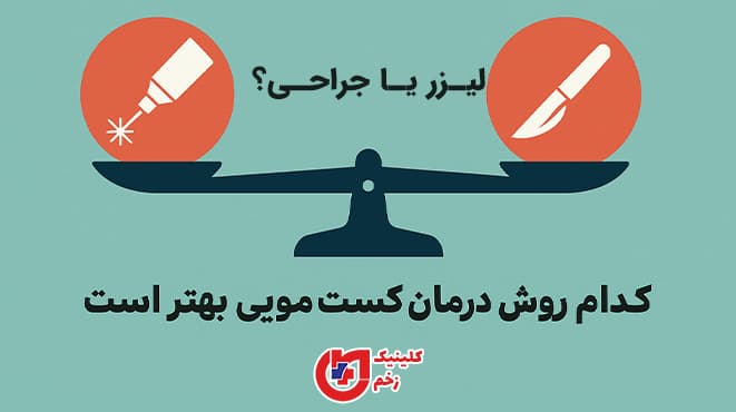 تصویر گرافیکی مقایسه لیزر و جراحی برای درمان کیست مویی با نوشته فارسی و نماد ترازو