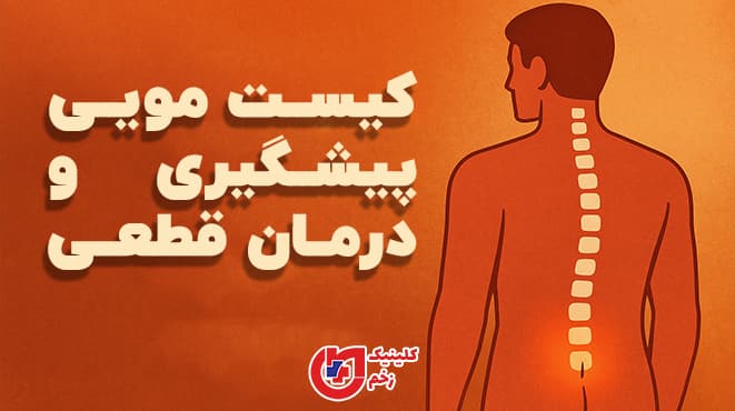 طرح گرافیکی به رنگ‌های گرم که یک سیلوئت انسانی را نشان می‌دهد و ناحیه دنبالچه با هایلایت قرمز مشخص شده و متن فارسی «کیست مویی: پیشگیری و درمان قطعی» در بالای تصویر قرار دارد.