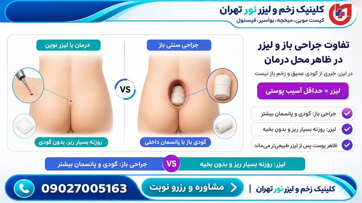 مقایسه روشهای مختلف درمان کیست مویی