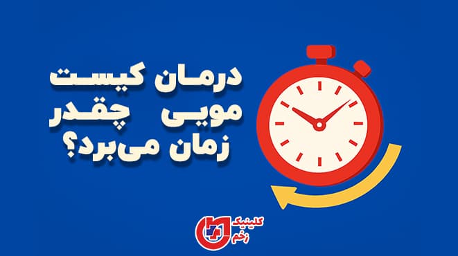 تصویر گرافیکی از زمان درمان کیست مویی با ساعت و متن فارسی