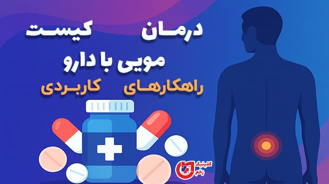 تصویر گرافیکی افقی با پس‌زمینه گرادیانت، نمایش یک انسان از پشت با ناحیه درد در پایین کمر و نمادهای دارو (قرص و شیشه پزشکی) همراه متن فارسی «درمان کیست مویی با دارو | راهکارهای کاربردی»