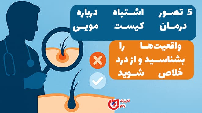 اینفوگرافیک پزشکی فارسی با تصویر دکتر، بررسی ۵ تصور اشتباه درباره درمان کیست مویی و دعوت به شناخت واقعیت برای جلوگیری از عود