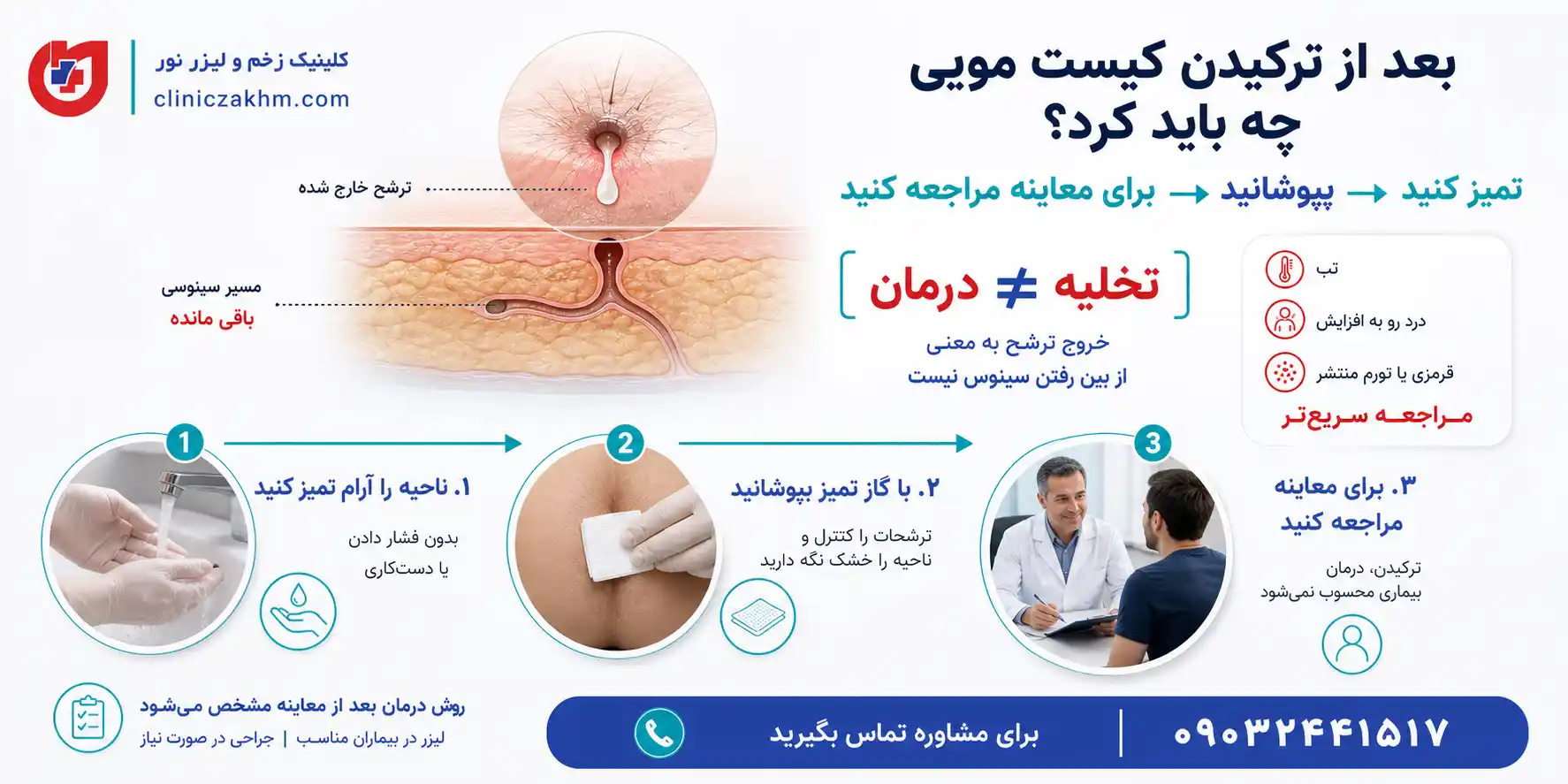 اقدامات لازم بعد از ترکیدن کیست مویی
