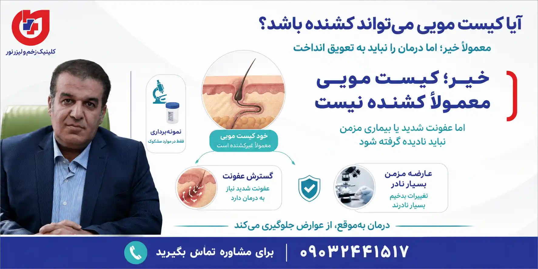 بررسی خطرات کیست مویی و اینکه آیا سینوس پیلونیدال می تواند عوارض جدی ایجاد کند