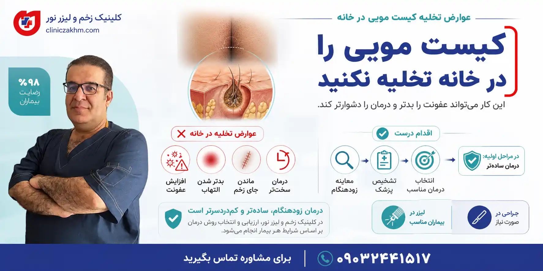 عوارض تخلیه کیست مویی در خانه