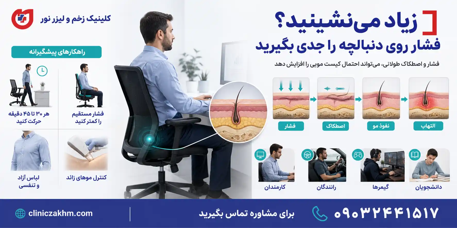 نکته مهم درباره عوامل کمتر شناخته شده در ایجاد کیست مویی