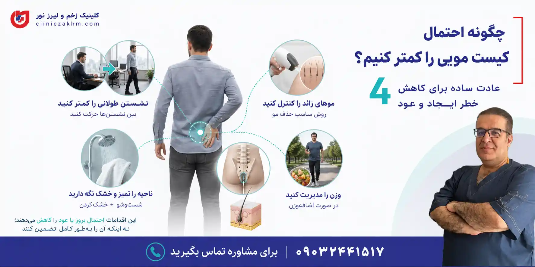 روش های پیشگیری از کیست مویی