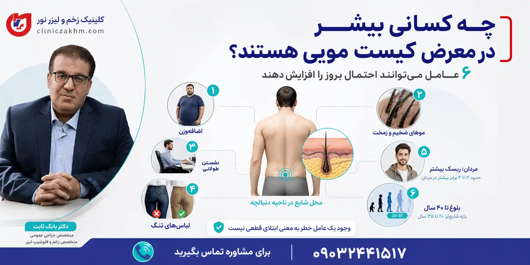 افرادی که بیشتر در معرض ابتلا به کیست مویی هستند