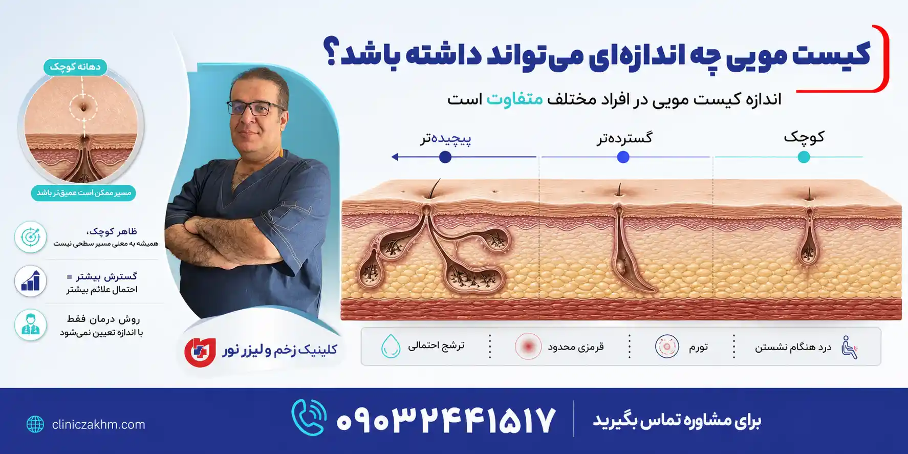 اندازه کیست مویی و بررسی تفاوت اندازه سینوس پیلونیدال در مراحل مختلف