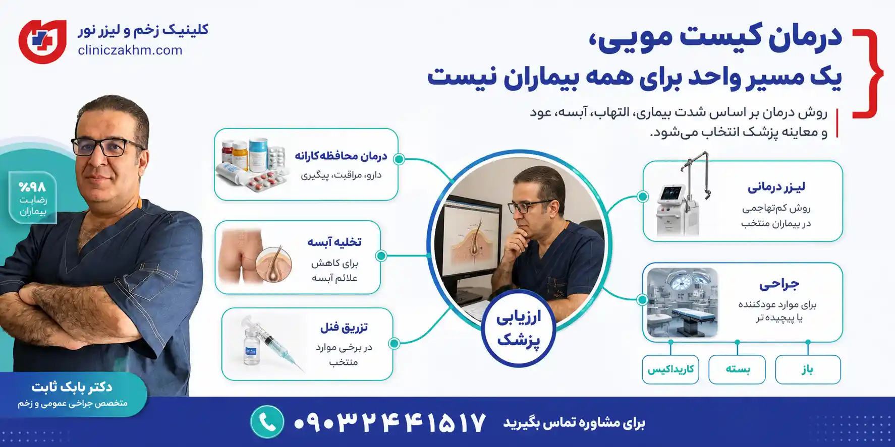 روش های درمان کیست مویی