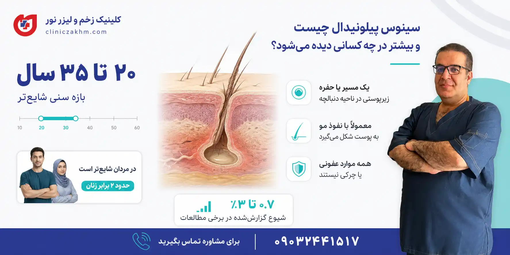 تعریف سینوس پیلونیدال و بررسی میزان شیوع این بیماری در افراد مختلف