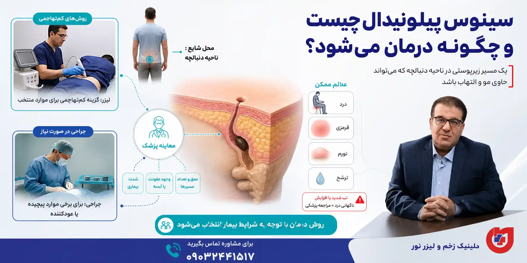 سینوس پیلونیدال چیست و چگونه درمان می شود؟