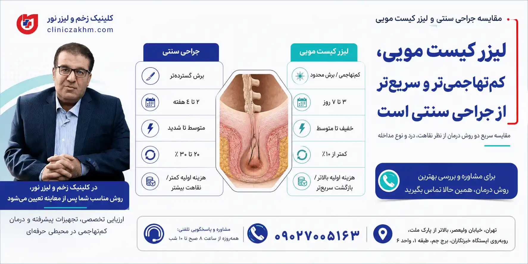 مقایسه جراحی سنتی و لیزر کیست مویی از نظر روش درمان