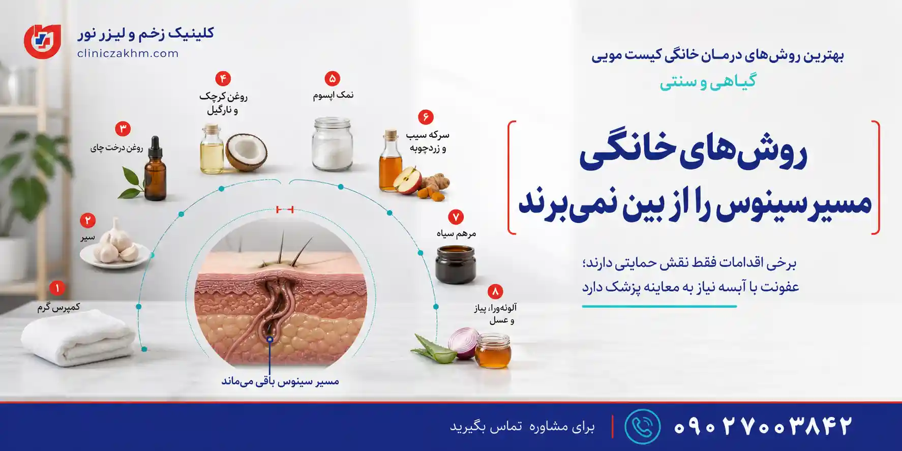بهترین روش‌های درمان خانگی کیست مویی