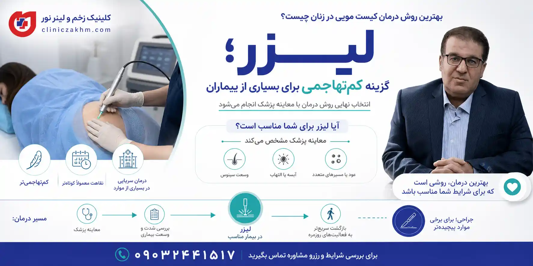 بهترین روش درمان کیست مویی در زنان