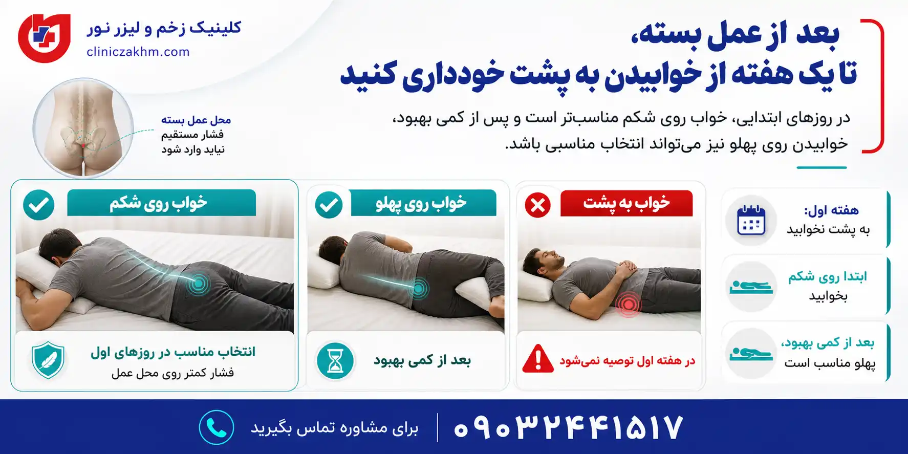 نحوه خوابیدن بعد از عمل بسته سینوس پیلونیدال و مراقبت از محل بخیه