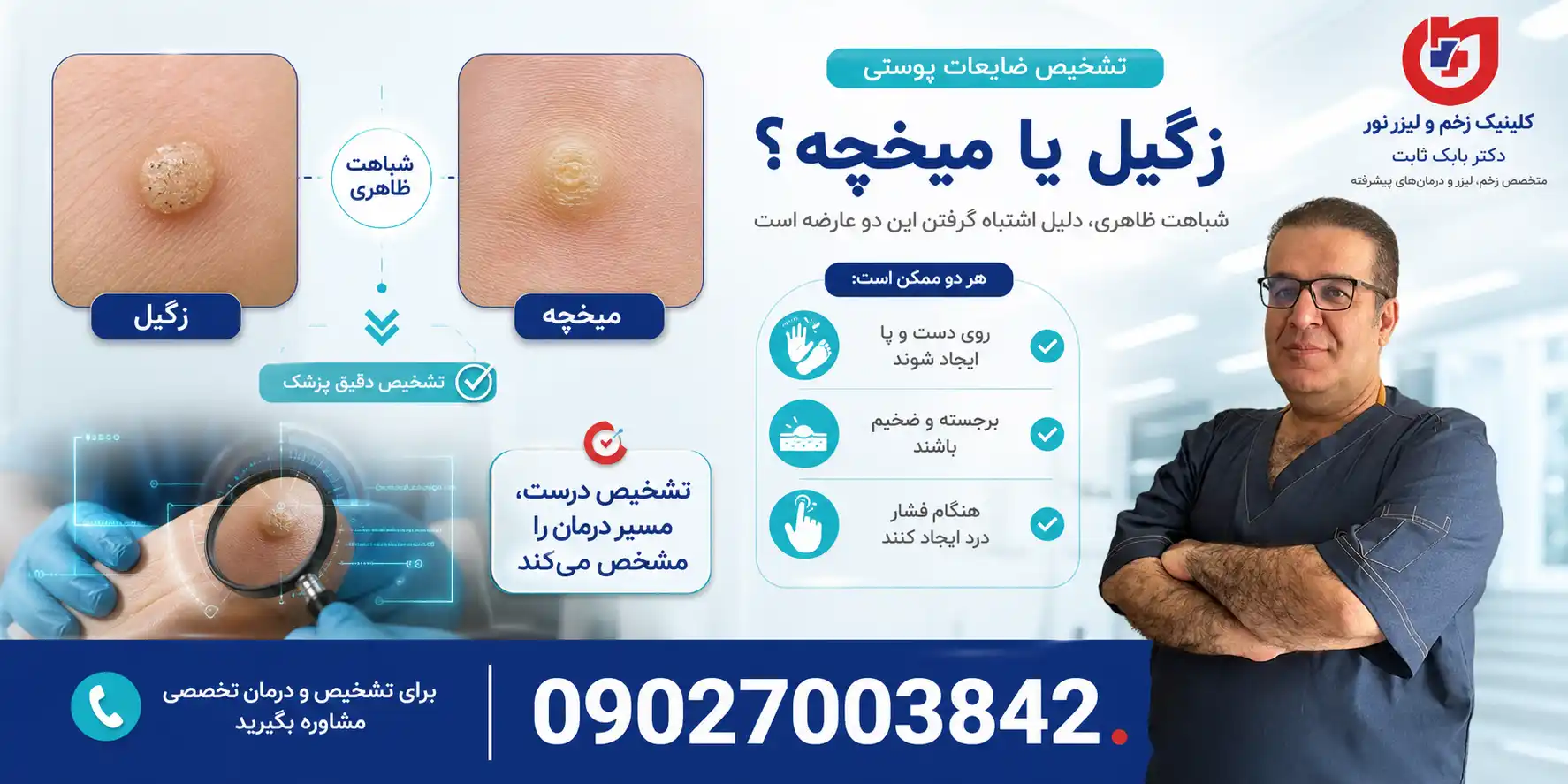 شباهت زگیل و میخچه