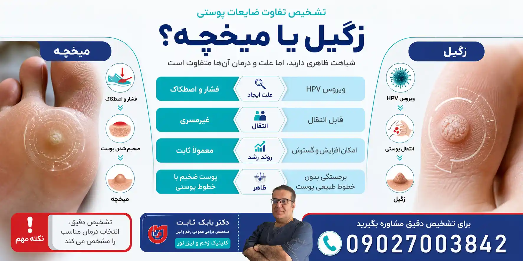 فرق زگیل و میخچه