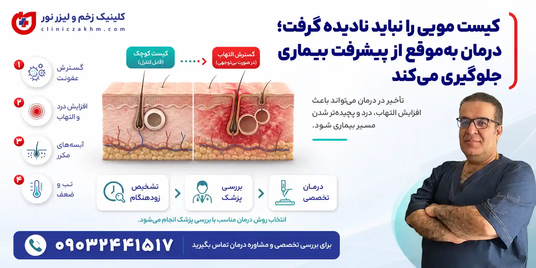 بررسی نیاز به عمل جراحی برای درمان کیست مویی و شرایط انتخاب روش درمان