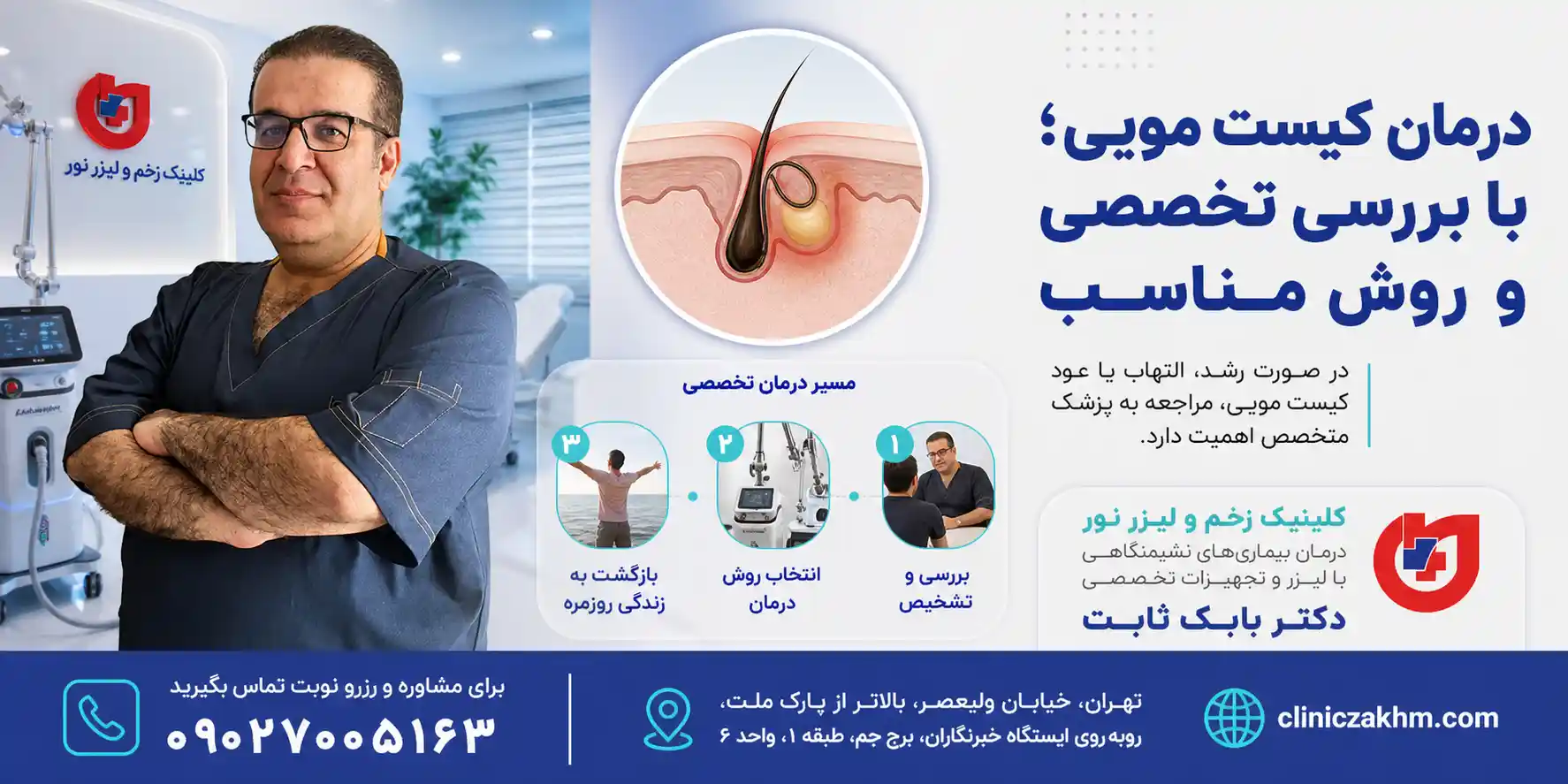 روش های درمان کیست مویی رشد کرده