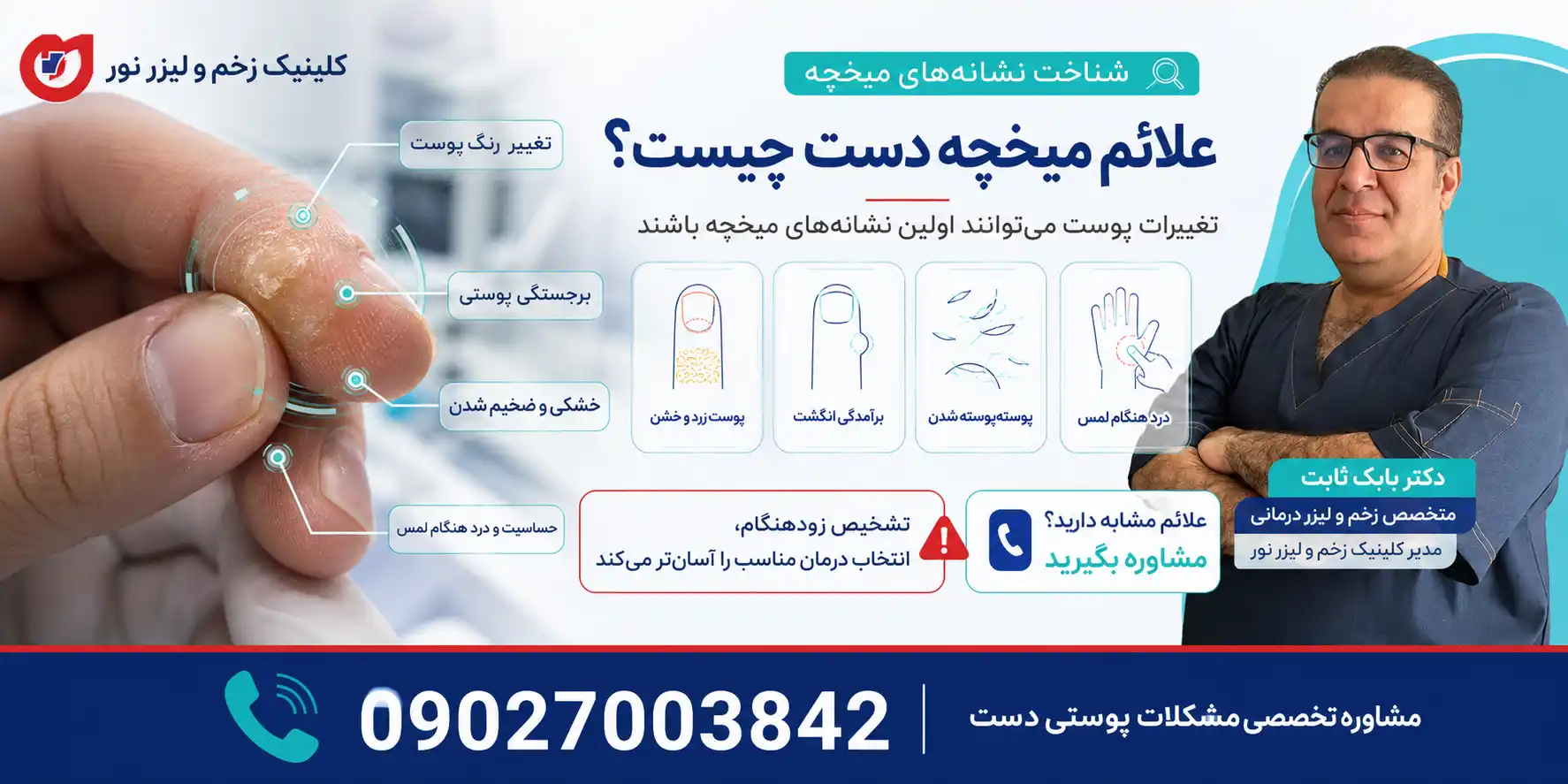 علائم میخچه دست