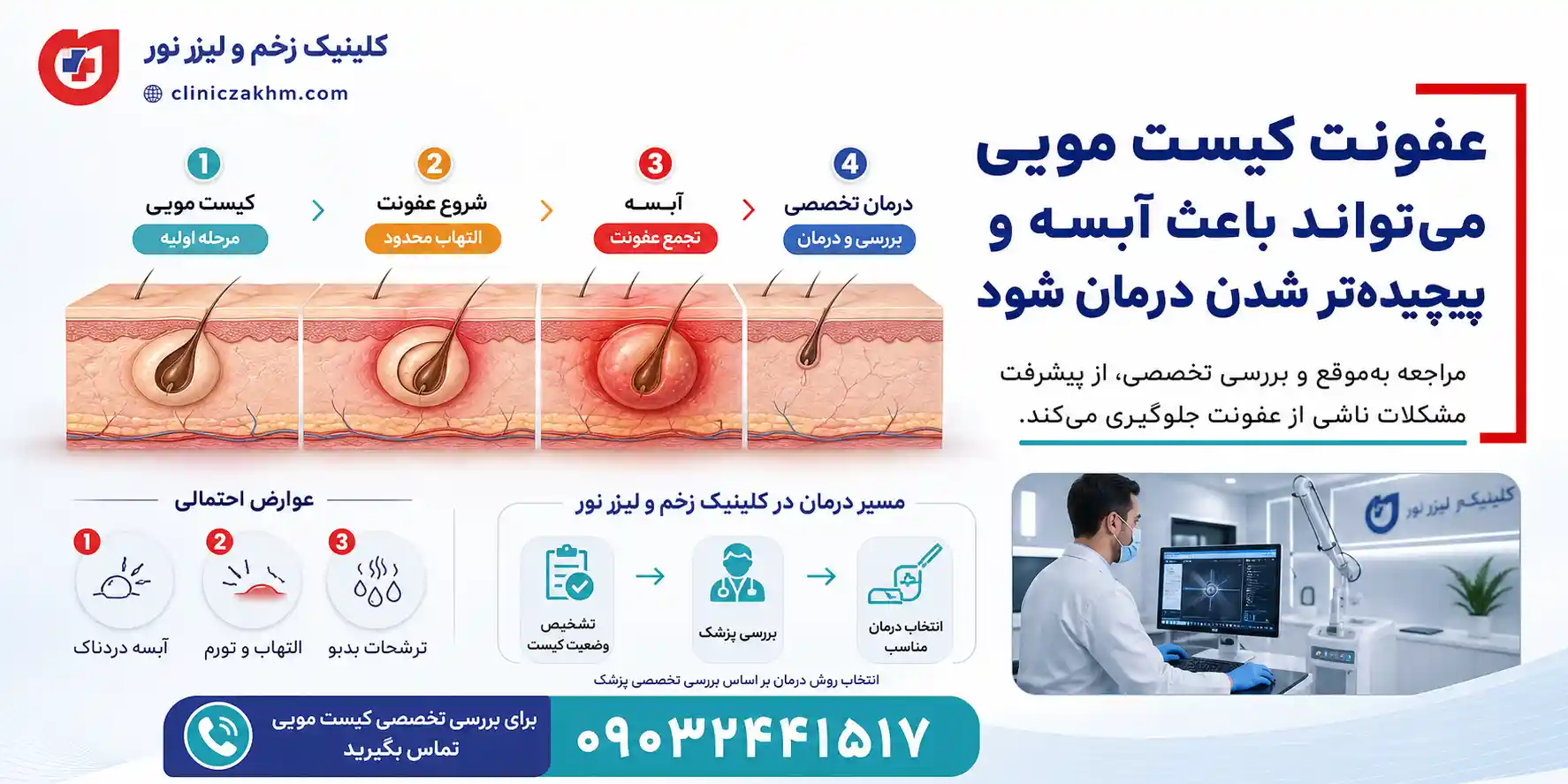 خطرات کیست مویی در پایین کمر و عوارض احتمالی سینوس پیلونیدال درمان نشده
