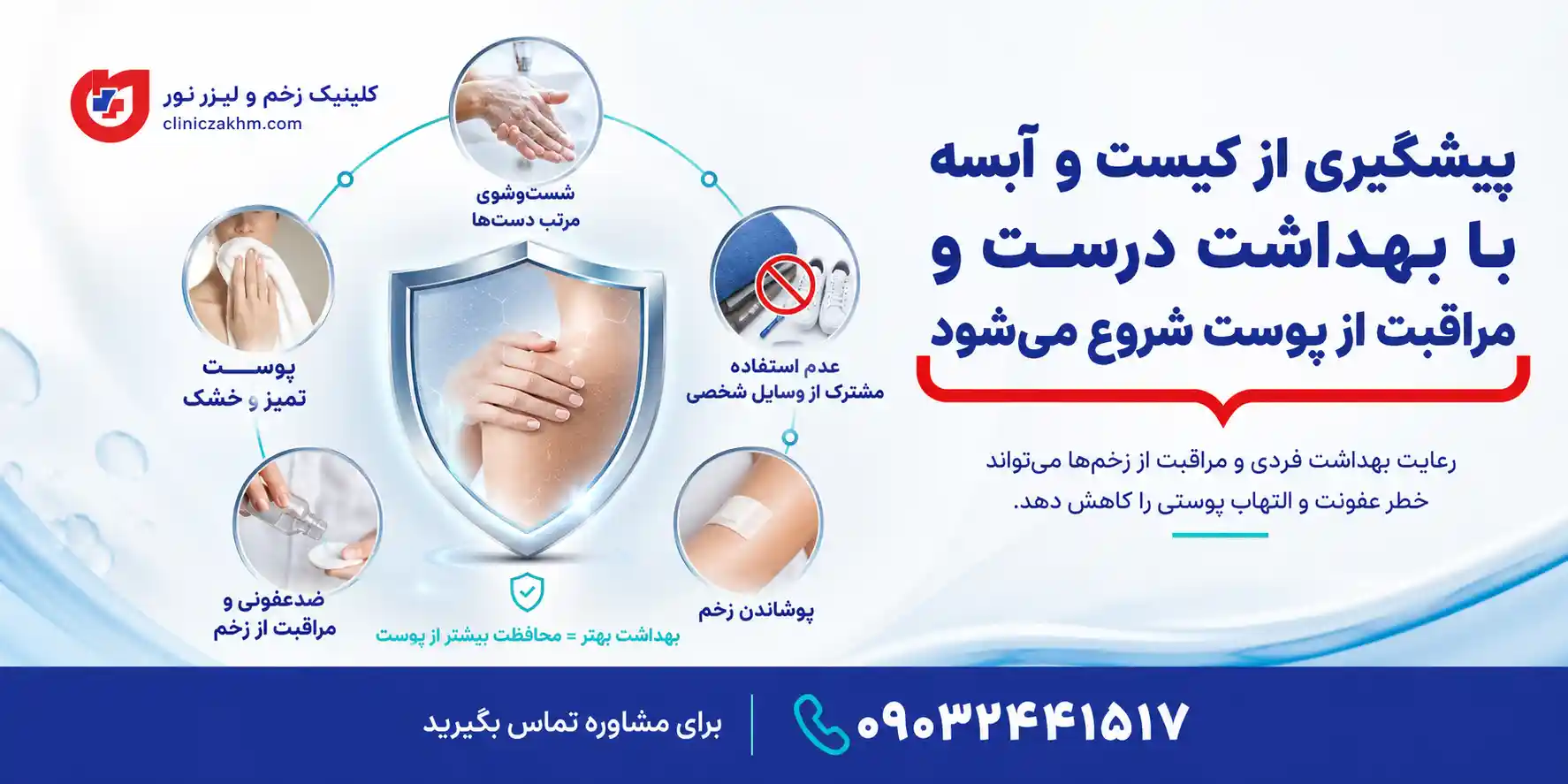 نکات پیشگیری از کیست مویی و آبسه
