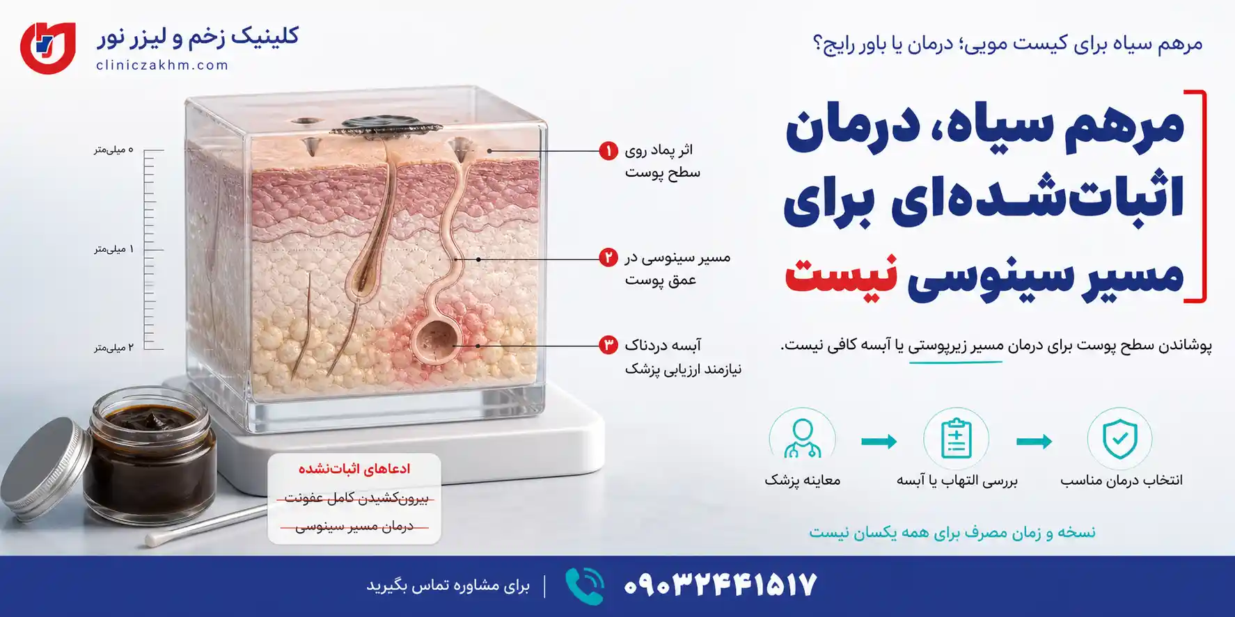 درمان خانگی کیست مویی با مرهم سیاه