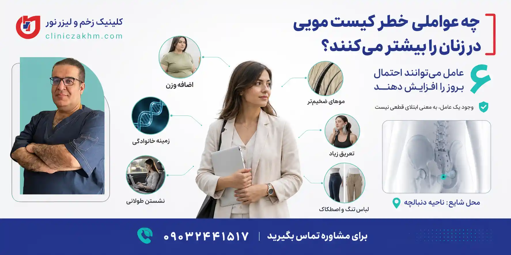 عوامل ایجاد کیست مویی در زنان و دلایل بروز سینوس پیلونیدال