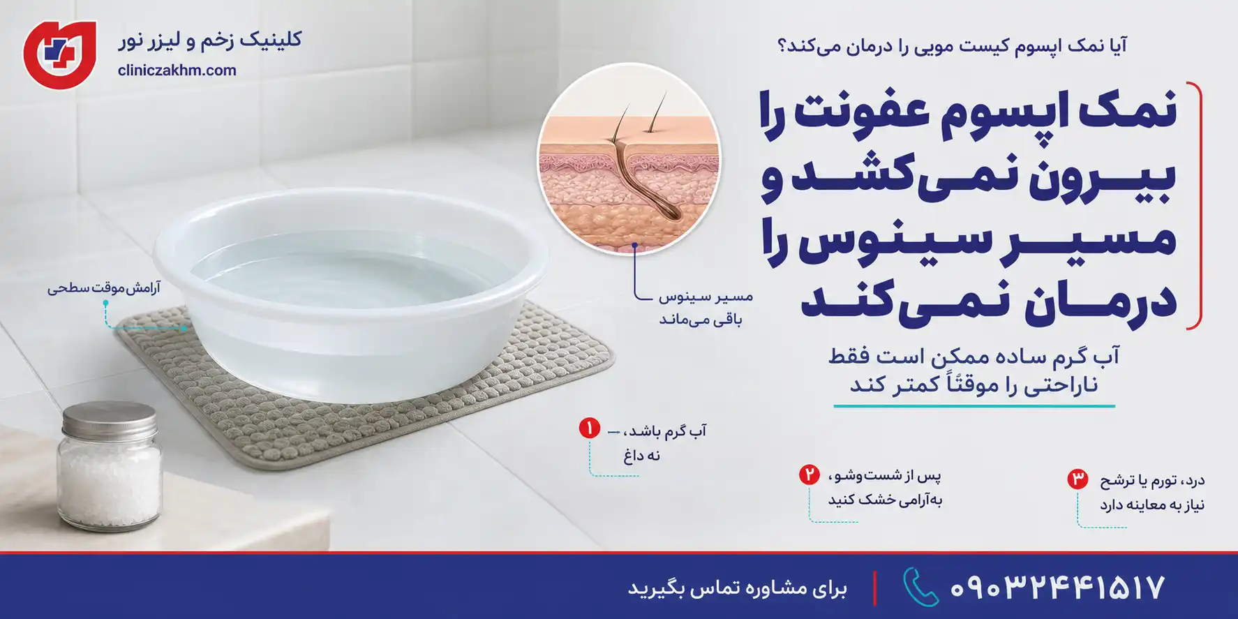 درمان خانگی کیست مویی با نمک اپسوم