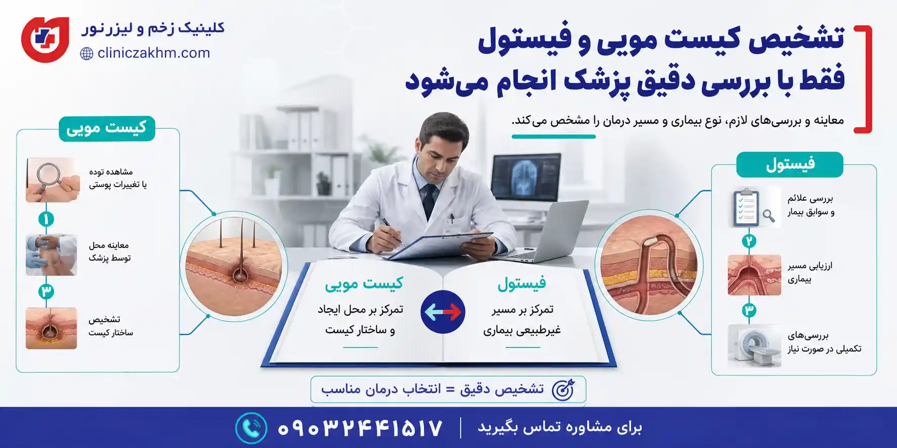 تفاوت روش تشخیص کیست مویی و فیستول