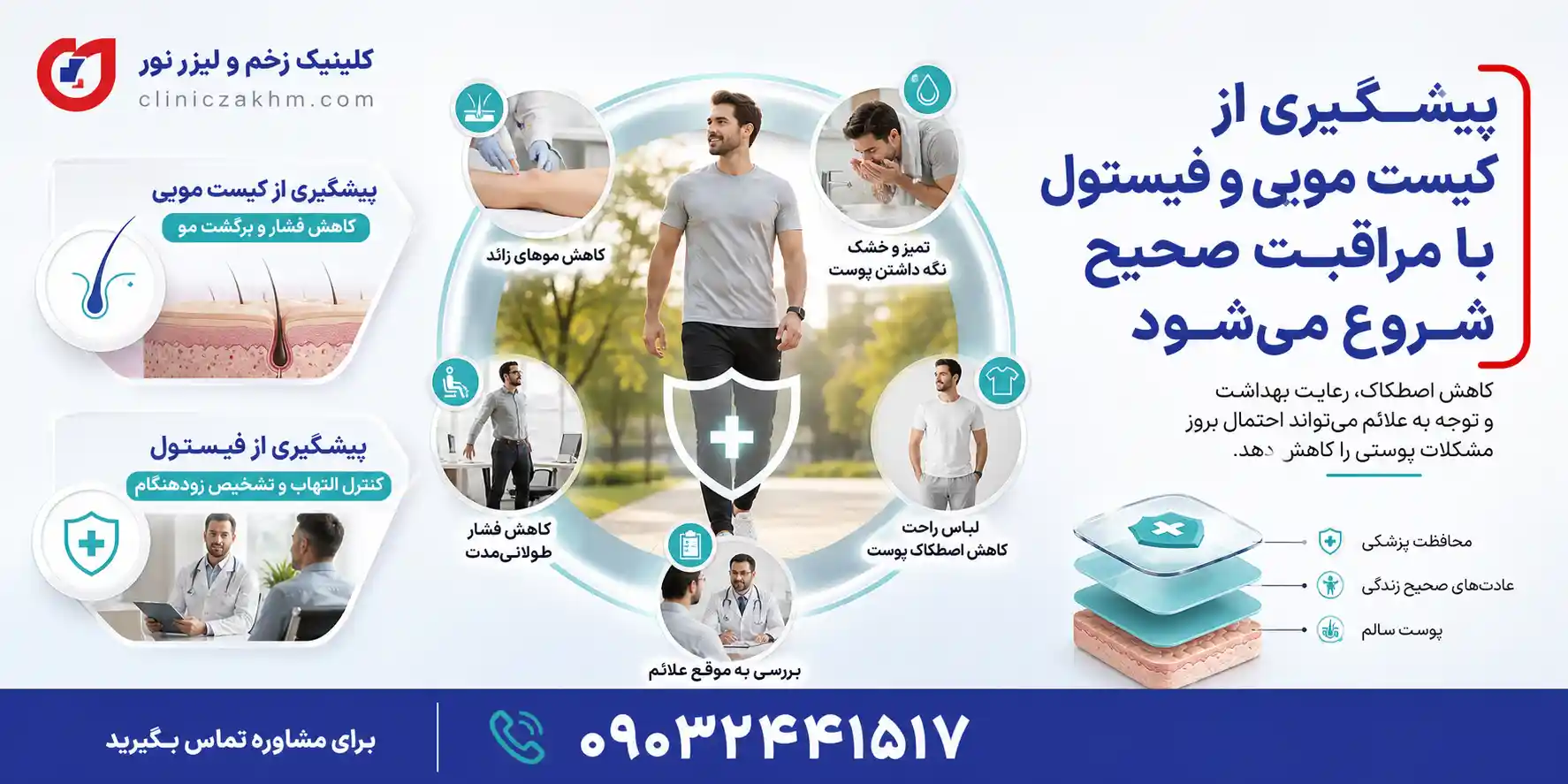 روش های پیشگیری از کیست مویی و فیستول و مراقبت های لازم برای کاهش احتمال ابتلا