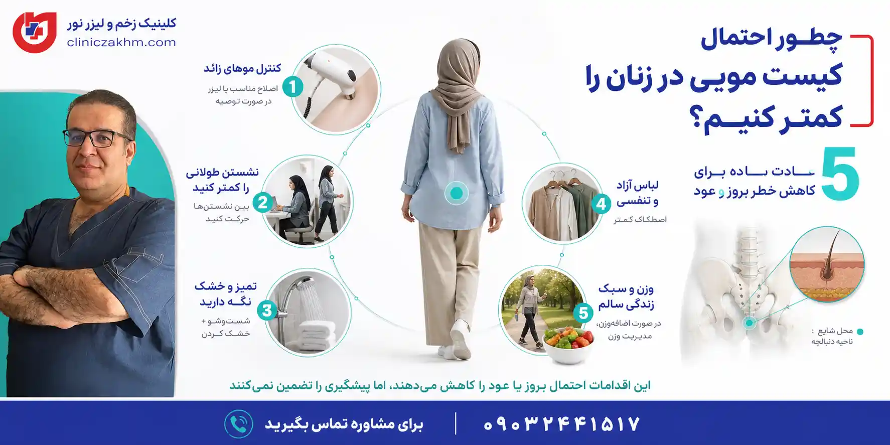 روش های پیشگیری از کیست مویی در زنان
